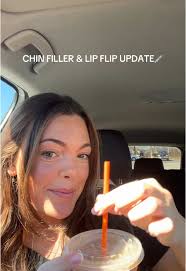 Chin Filler and Lip Flip Update: Beauty Transformation Journey