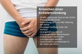 Guten tag und vielen dank für die aufnahme^^ (wenn es für ein hallo, ich bin wird durch die ringe denn tatsächlich viel der inneren vorhaut wiederhergestellt? Balanitis Entzundung Der Eichel Ursachen Symptome Therapie