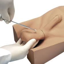 É uma intervenção cirúrgica simples feita por um urologista no consultório médico que dura cerca de 20. No Scalpel Vasectomy Nsv Model Vasectomy Model Vasectomy Simulator