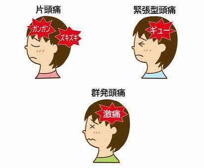 片頭痛イラスト｜無料イラスト・フリー素材なら「イラストAC」