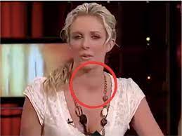 One reason is responsible why some cancers have a superior dying toll. Throat Cancer Highlighted By Australian Star Chris Nutting Oncology