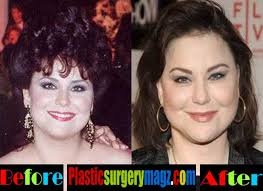 Her appearance looks weird after having some beauty surgeries done. Delta Burke Plastic Surgery Before And After Photos Plastic Surgery Magazine
