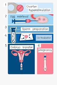 Intracytoplasmic Sperm Injection Process Ivf Flow Chart