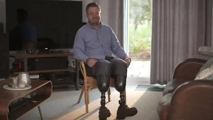 Surgeon Neil Hopper jailed after amputation of own legs - BBC News