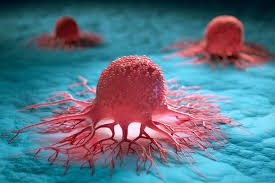 Doublet of canker and chancre. Breast Cancer Webmd Breast Cancer Health Center