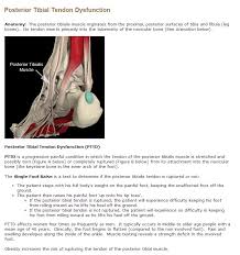 Check spelling or type a new query. Posterior Tibial Tendon Dysfunction Athlepedia The Athletics Wiki Fandom