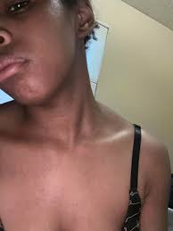 Due in 2.5 weeks and I've been using panoxyl basically my entire pregnancy.  I am now coming across mixed reviews