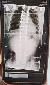 This definitely gave me hope. Vqovncmqi43zgm