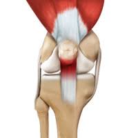 1,10,12,28,30,46,66,81 these studies assessed patellofemoral pain in general. Jumper S Knee Portland Patellar Tendinitis Knee Injury Portland Beaverton