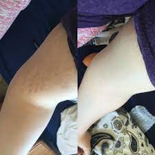 Why Veil Cover Cream Is The Best Stretch Mark Concealerveil Cover Cream Blog