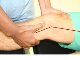 Image result for Lachman Test