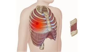 It is formed by the vertebral column, ribs, and sternum and encloses the heart and lungs. Intercostal Muscles Rib Pain Back Pain Chest Pain Niel Asher Education