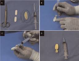 Image result for Nasal Packing