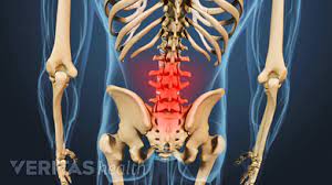 The real cause is likely to be tight psoas muscles, which cause the lower back to curve pushing out the stomach. 4 Reasons You May Have A Stiff Back