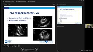Contactez pour rendez vous le centre de radiologie par téléphone. Webmasterclass Echo En Chirurgie Cardiaque 23 24 Nov 20 Arcothova