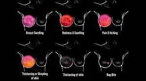 Image result for Inflammatory breast cancer