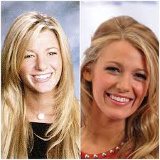 Did these stars grow into their looks or was it plastic surgery? :  r/VindictaRateCelebs