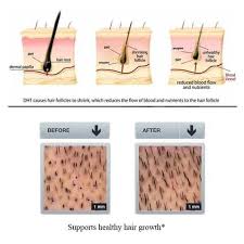 Hair Restore Biotin Hair Growth Serum Review 7 Day Ginger Germinal Serum Genie Gears Hair Growth Serum Hair Regrowth Serums Hair Regrowth