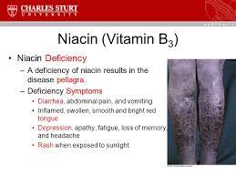 The lack of vitamin b3 can result in different types of issues like digestive problems, weak muscles, skin irritation or pellagra. Bms208 Human Nutrition Topic 10 The Water Soluble Vitamins B Vitamins And Vitamin C Chris Blanchard Ppt Video Online Download
