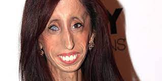 He has not done any surgery or hasn't gone through any treatment for this look. Herstory The World S Ugliest Woman