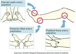 What Tests Are Carried Out To Diagnose Pad Otsuka Pharmaceutical Co Ltd