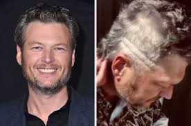 The official blake shelton twitter. Blake Shelton Has A Mullet Now By The Way