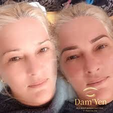 En Dam'Yen encontrarás la oportunidad de darle vida a tu rostro, se  realizan limpiezas faciales a profundidad con muy buenos resultados, para  ver los cambios, asistir mínimo 1ves al mes. Se realiza