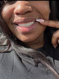 Porcelain Veneers and Teeth Contouring Experience in Atlanta