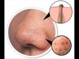 Pin On عماد ميزاب