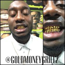 You want permanent gold teeth come to gold money grillz book appoinment  Today 954-933-7029
