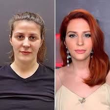 Dog in crop top sparks conversation