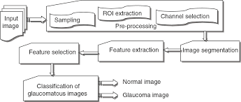 Retinal Fundus Image For Glaucoma Detection A Review And
