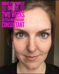 Eye cream for sensitive eyes and hydration?