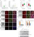 Nuclear DLC1 exerts oncogenic function through association with ...