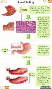 د سليمان حاجي dr hajji on twitter health and nutrition health and beauty tips medical words