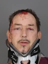 Webster and Irondequoit police sued by driver injured in crash