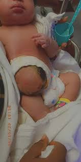 This will allow you to keep one hand on the baby at all times. Nigerian Woman Gang Raped In Ghana Loses Her Newborn Baby Conceived From The Rape Incident