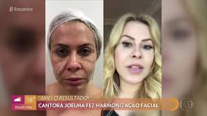 Apesar de ter entrado na tv globo em 1987, no rjtv, fátima. Encontro Com Fatima On Twitter O Encontro De Hoje Comeca Falando Sobre Harmonizacao Facial Voce Sabe O Que E Qual Sua Opiniao Sobre O Procedimento Fique Com A Gente E Entenda Melhor