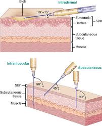Image result for Subcutaneous Injection