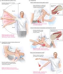 Image result for Drop Arm Test