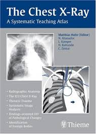 We did not find results for: The Chest X Ray A Systematic Teaching Atlas Matthias Hofer 9781588905543 Amazon Com Books