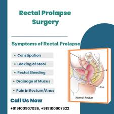 Image result for Rectal Prolapse