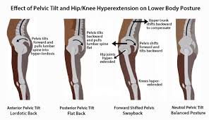 Psoas Talk With Christye Volt Blog In 2020 Body Posture Pelvic Tilt Hip Flexor