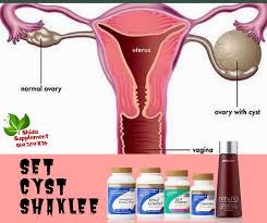 A prolonged periods or absence of peritoneal infusion of saline incision or abdomen through small incisions lack of knowledge some kind. Kenali Penyakit Cyst Shidarahmat