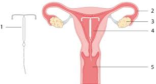 Aus medizinischer sicht ist das vollkommen unbedenklich. Die Spiralen Sex I Ch Sexual Health Info