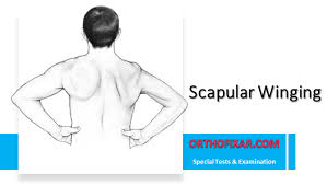 Image result for Winged Scapula