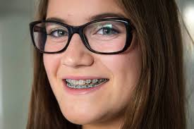 How do you remove braces from teeth? Brace Yourself Those Teeth Will Cost A Lot To Fix Stuff Co Nz