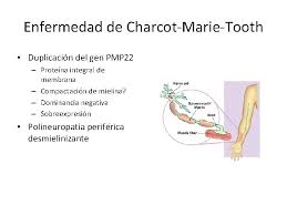 We did not find results for: Variabilidad Genetica Mutaciones Dra Mary Dominguez Mutaciones Cambio