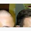 Most black women have a very coarse hair. Https Encrypted Tbn0 Gstatic Com Images Q Tbn And9gcq84gnnpmiize8oykrxfuhhuc2xiih4skjbic44l2t5ygtc7erl Usqp Cau