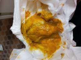 bebek kaka rengi ve anlamlari ebebekce